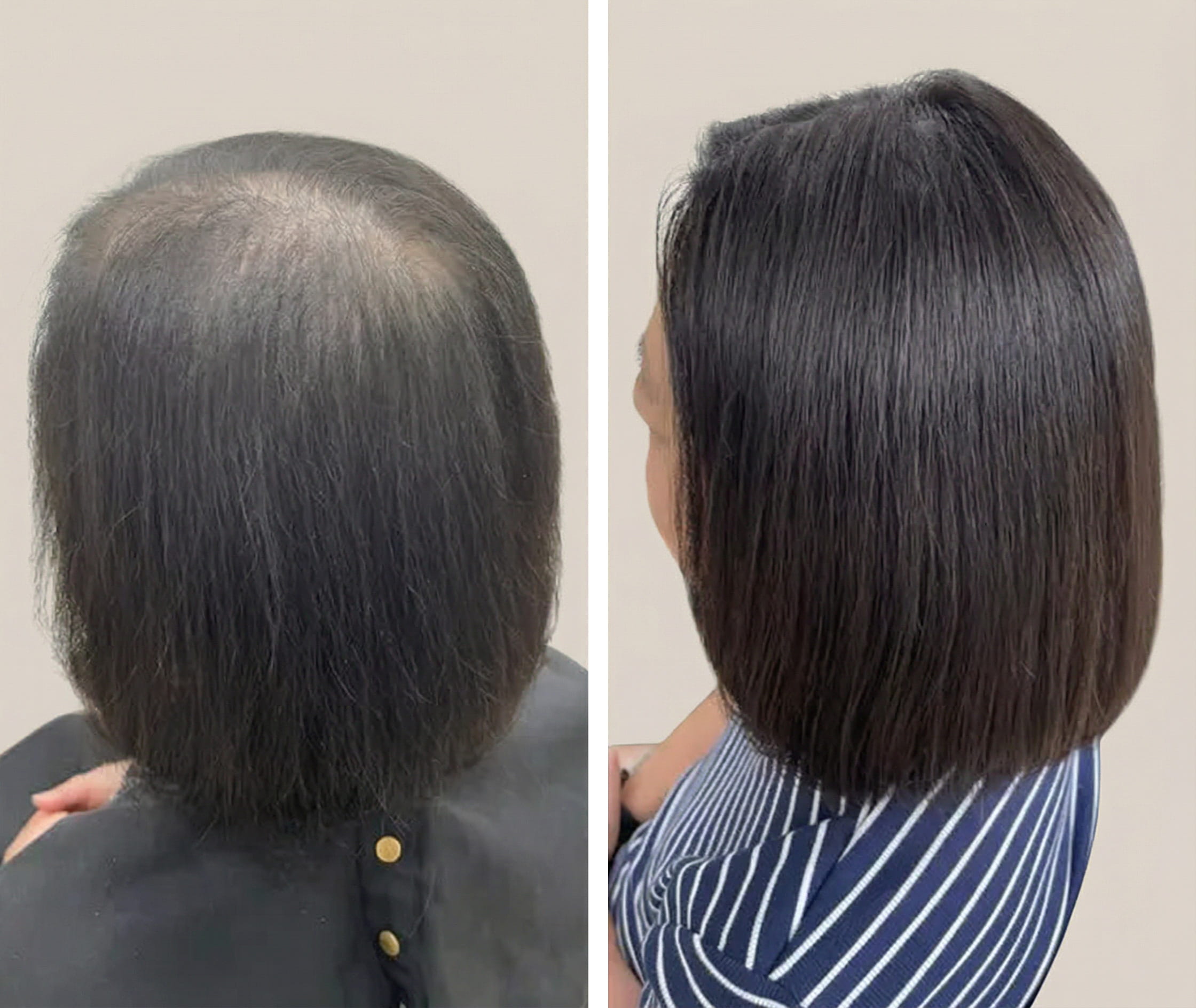 Seamless blend adding fullness and confidence.